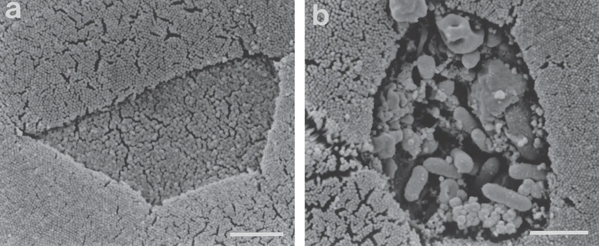 Figure 414 Scanning electron micrographs of mouse Peyers patches a before - фото 61
