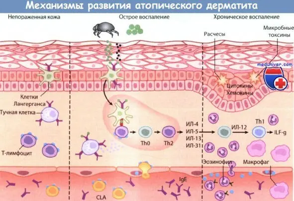 Давайте рассмотрим немного подробнее строение кожи Есть такие клетки - фото 4