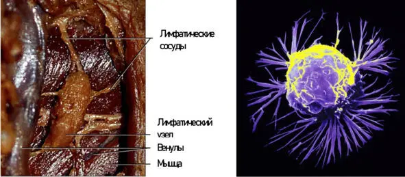 Рис 6 Препарированный лимфоузел А и электронная фотография лимфоузла Б - фото 6