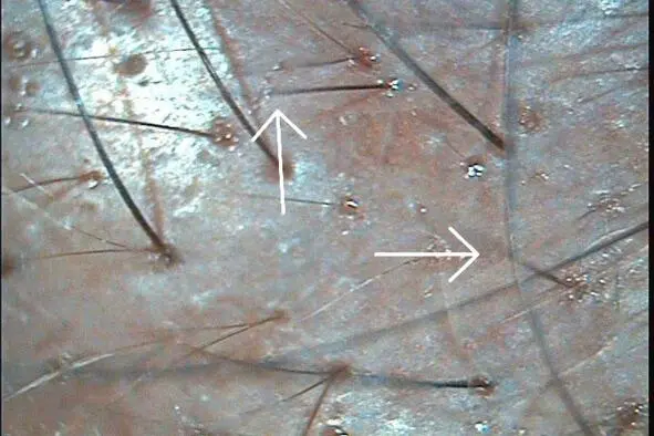 Эта фаза длится от 2 до 8 12 лет за это время волос вырастает на свою - фото 1