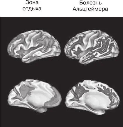 Рис 32 Существует поразительное сходство между зонами мозга активизируемыми - фото 31