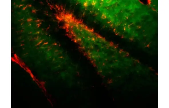 Клеткипредшественники нейронов гиппокампа На самом деле восстанавливаются И - фото 1