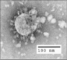 elektronmikroskopbillede af SARSvirion Klassificering af virus ikke - фото 3