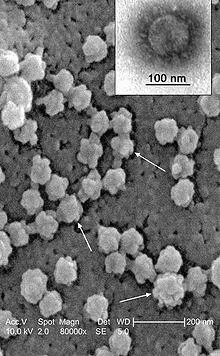MICROGRAFIA ELECTRÒNICA de rastreig del SARS virions Segona part Síndrome - фото 6
