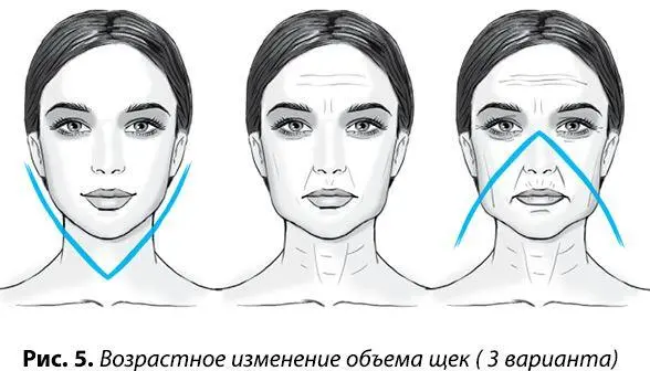 Синяки под глазами придают лицу уставший изможденный вид И это правда - фото 9