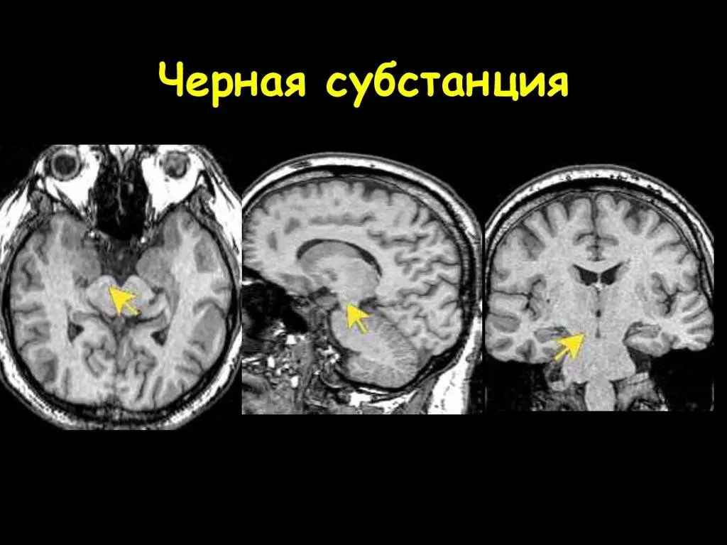 Рис 8 Расположение чёрной субстанции рисунок из интернета Название чёрное - фото 9