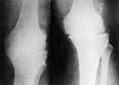 Рис 5 Общие принципы лечения заболеваний суставов Лечением любого - фото 5