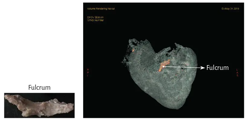 Figure 141 Computed tomography of the cardiac fulcrum bovine heart The - фото 18