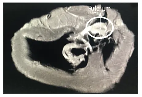 Figure 144 Nuclear magnetic resonance image in the bovine heart The - фото 21