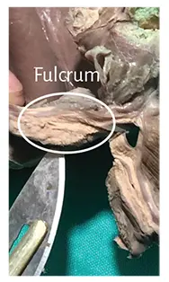 Figure 126 Fulcrum resected from an adult human heart Figure 127 The - фото 13