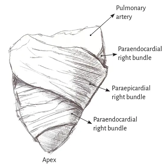 Figure 18 Right ventricular free wall Three segments can be identified at - фото 4