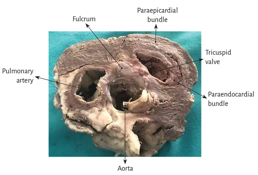 Figure 116 Descriptive photograph of the muscle bundles emerging from the - фото 7