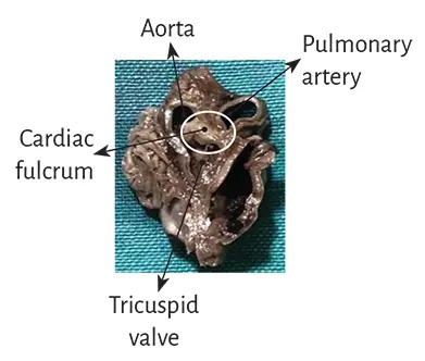 Figure 123 Cardiac fulcrum in a 23week gestation human embryo hear Figure - фото 11