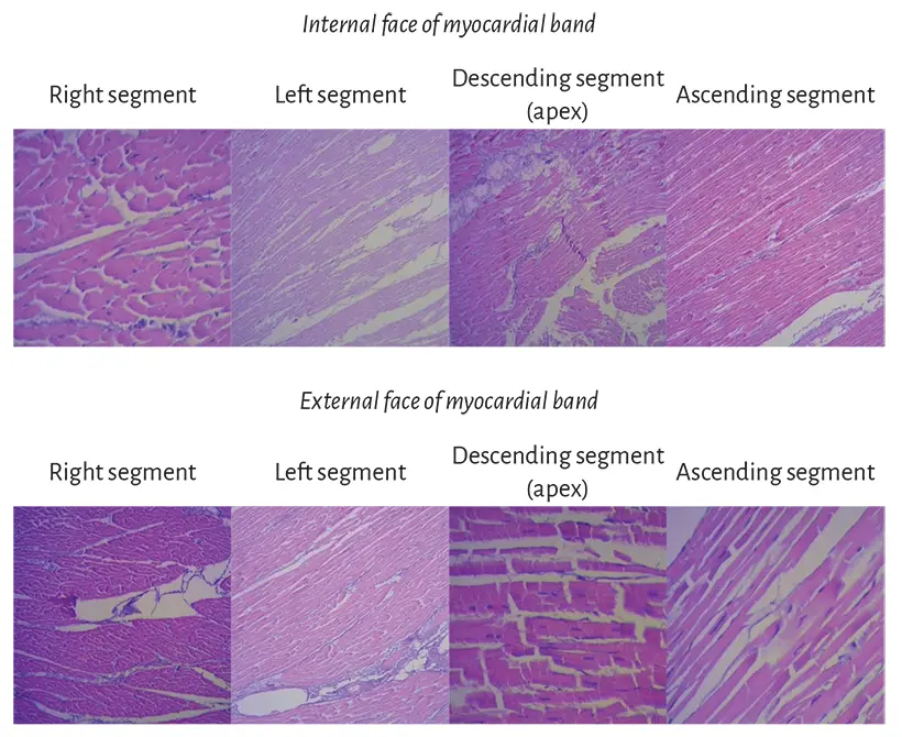 Figure 114 Segment sequence from the myocardial band histological analysis - фото 6