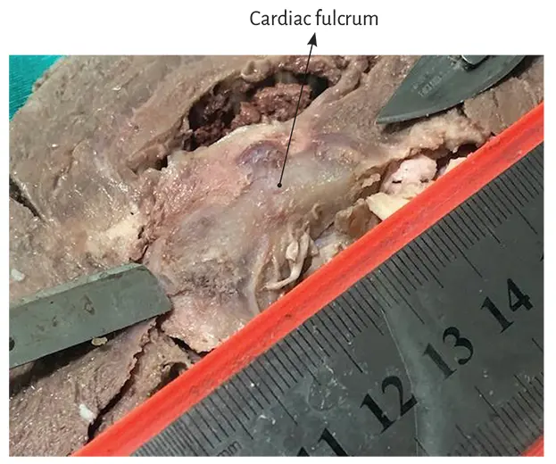 Figure 110 Cardiac fulcrum in the bovine heart It should be understood that - фото 5