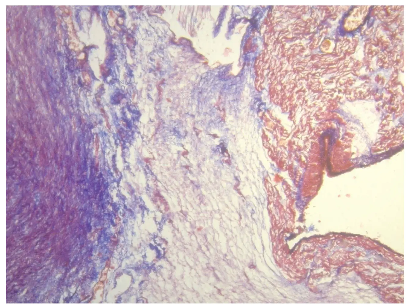 Figure 132 Cardiac fulcrum in a 23week gestation fetus showing prechondroid - фото 15