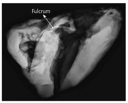Figure 145 Radiologic image of the cardiac fulcrum with mammography technique - фото 22