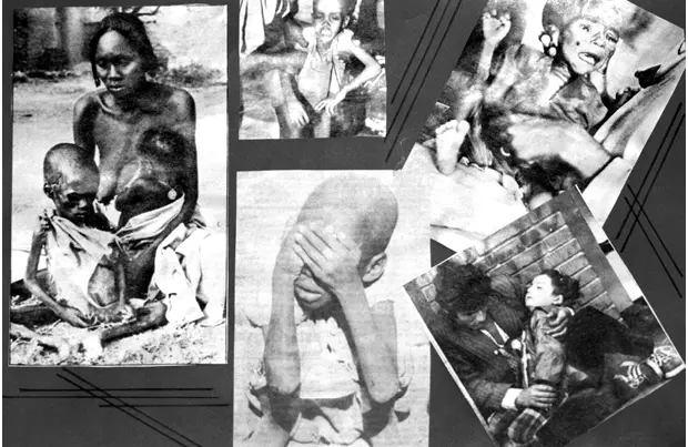 Panel con fotos de niños hambrientos colgada en la pared de su despacho Si - фото 4