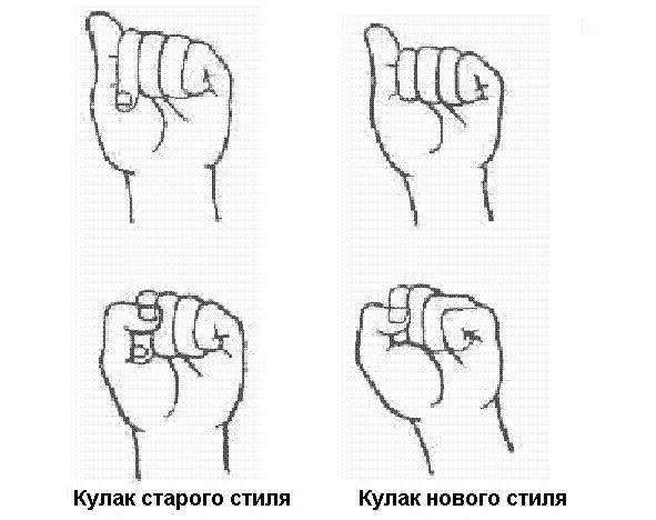 Рис 3 5 Существует значительное отклонение запястья относительно локтевой - фото 5