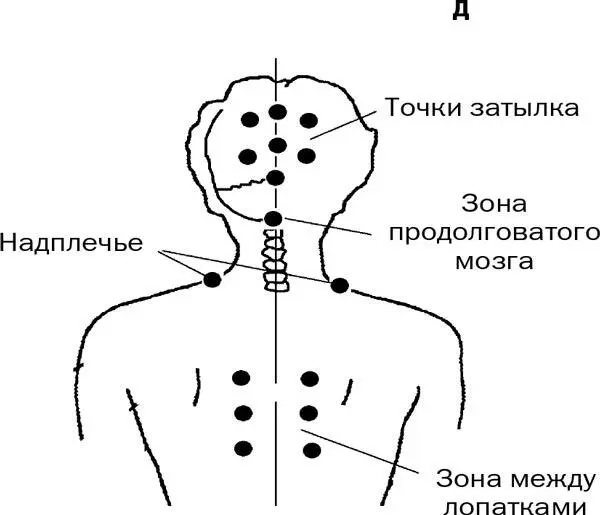 Рис 3 Точки против укачивания окончание Как только уйдет напряжение в - фото 16