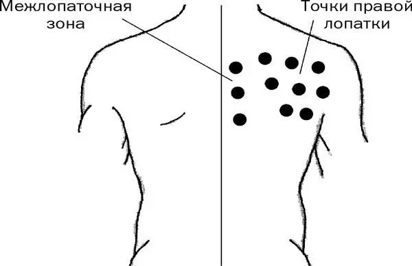 Рис 4 При печеночной колике 2 Ложимся на левый бок При этом разминаем - фото 17