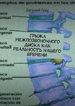 Евгений Гуцу Грыжа межпозвоночного диска как реальность нашего времени обложка книги