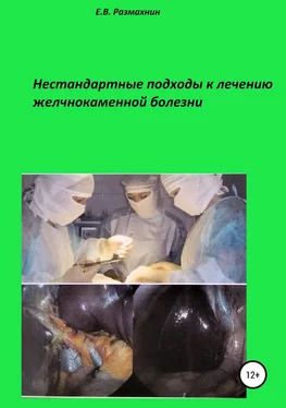 Евгений Размахнин Нестандартные подходы к лечению желчнокаменной болезни обложка книги