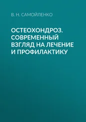 Валентина Самойленко - Остеохондроз. Современный взгляд на лечение и профилактику