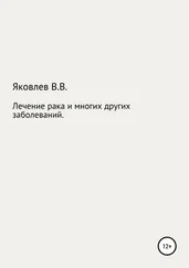 Вениамин Яковлев - Лечение рака и многих других заболеваний новым растительным препаратом «Цикутин»