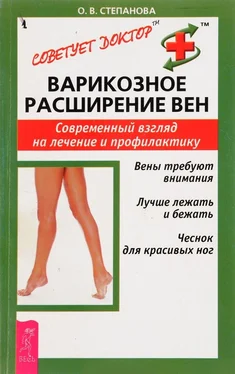 Ольга Степанова Варикозное расширение вен. Современный взгляд на лечение и профилактику обложка книги