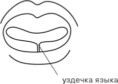 Уздечка языка это тяж слизистой оболочки который можно увидеть подняв - фото 10