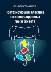 Зубаир Мехтиханов - Протезирующая пластика послеоперационных грыж живота