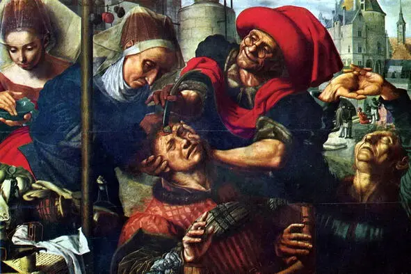 Ян ван Хемессен Извлечение камней глупости Аллегория 1545 год Гинзберга - фото 3