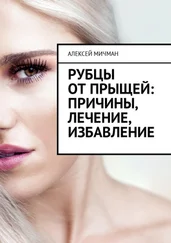 Алексей Мичман - Рубцы от прыщей - причины, лечение, избавление