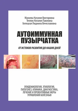 Наталия Теплюк Аутоиммунная пузырчатка. От истоков развития до наших дней обложка книги