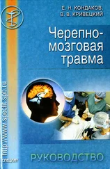 Евгений Кондаков - Черепно-мозговая травма. Руководство