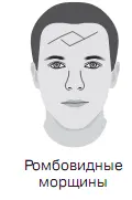 Знак болезни Тонкие короткие волнистые и рассеянные горизонтальные линии на - фото 11