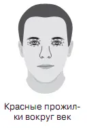 Знак рождения сына У беременной женщины коротенькие морщинки у верхней и - фото 17