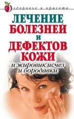 Екатерина Константинова - Лечение болезней и дефектов кожи. И жировик исчез, и бородавки