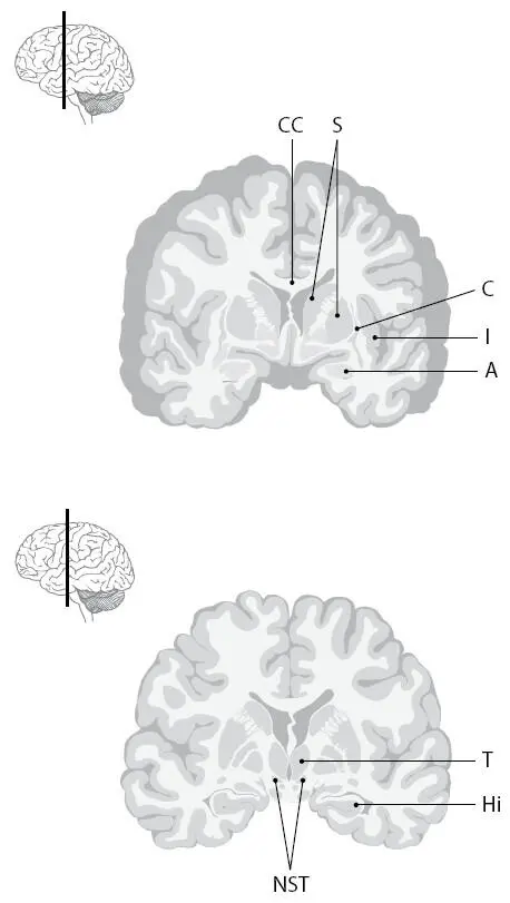 T таламус thalamus I острівець insula NST субталамічне ядро - фото 4