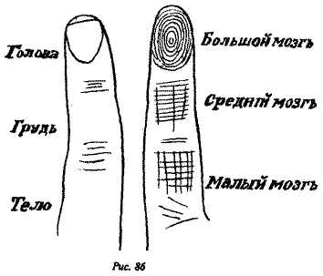 Если появляются утолщения на голове пальца то это указывает на интенсивную - фото 78