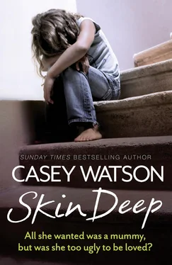 Casey Watson Skin Deep: All She Wanted Was a Mummy, But Was She Too Ugly to Be Loved? обложка книги