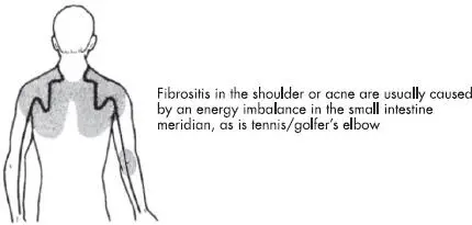 Fig 3b Energy congestions small intestine meridian Конец ознакомительного - фото 5