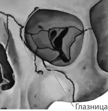 Рис 53 Костная орбита глаза Изза их возрастных подвижек пустоты глазниц - фото 59