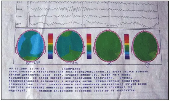 Первый эксперимент по исследования воздействия Музыкального ИЦзина автор - фото 12