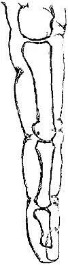 Fig ii Amputation of a distal phalanx This small operation is not very - фото 3