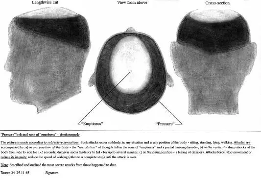 Picture 3 Flashbacks as described by the patient Convulsive flashback An - фото 18