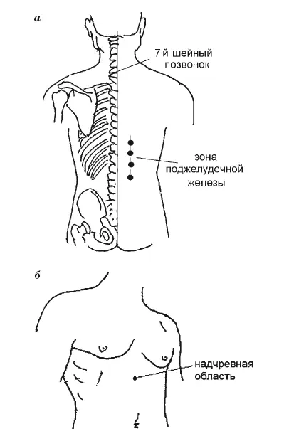 Рис 39 Действуем следующим образом 1 Укладываем пациента на живот находим - фото 116
