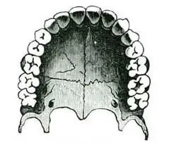THE TEETH 7 The TeethThe first teeth those which come when we are small - фото 6