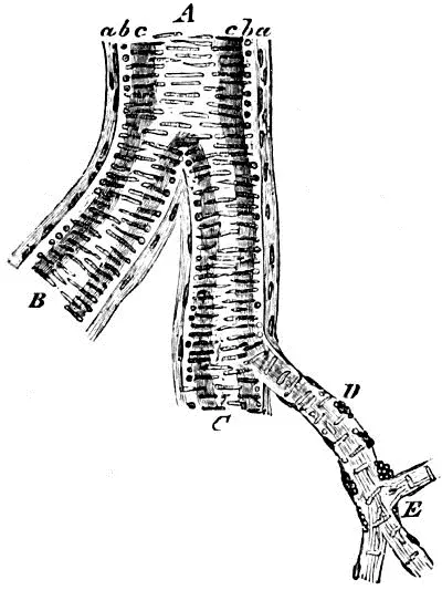 Fig 28 Kleine Arterie aus der Basis des Grosshirns nach Behandlung mit - фото 16